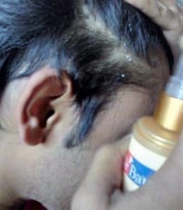 Dr. Batra's hair serum best review